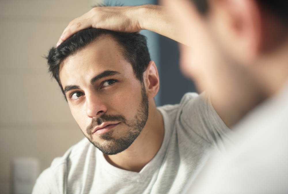 ALOPECIA ANDROGENÉTICA